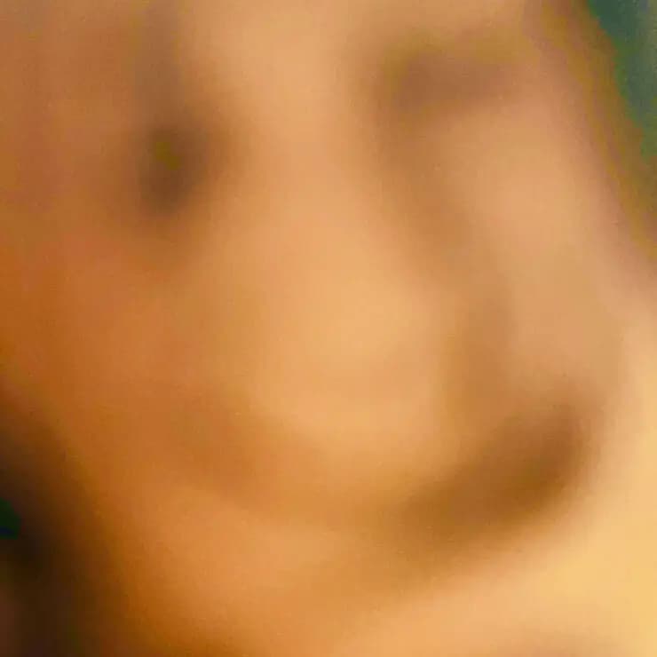初探:微笑病